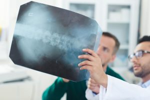 What is the Average Settlement for Spinal Stenosis?